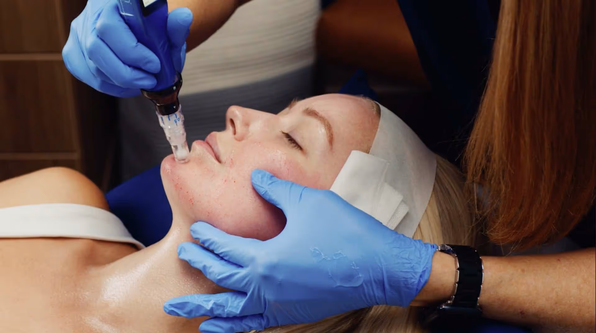 During Treatment